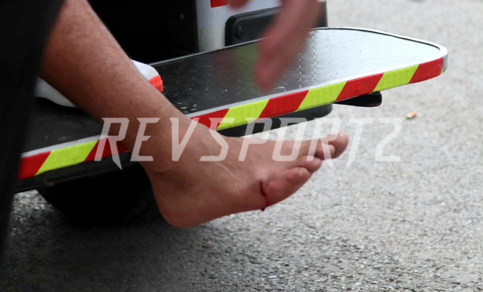 Rishabh Pant wheeled off the field – Blow to foot leaves it bloodied and swollen Pant_Injury